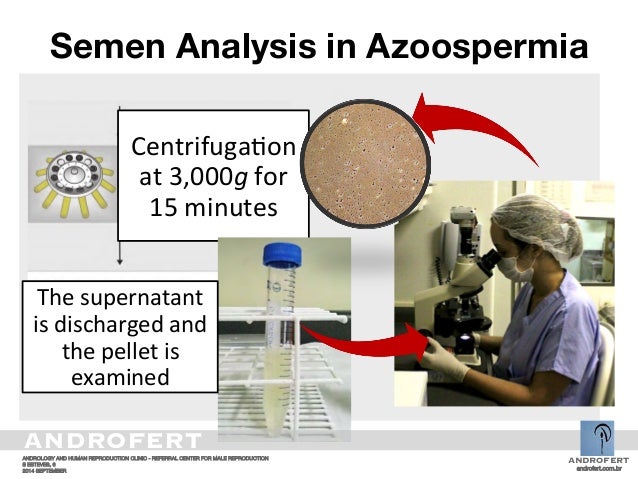 Sperm pellet analysis Barely leagal blow jobs